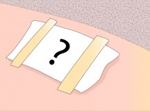 What-to-do-after-a-skin-biopsy